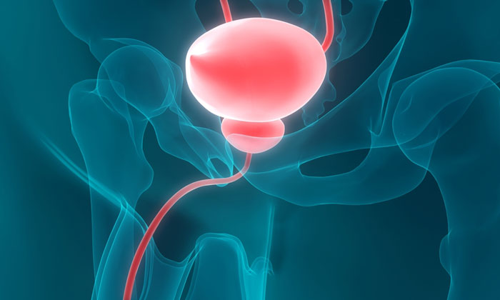 Bladder Cancer Tumor Specimens - Bay Biosciences, LLC.