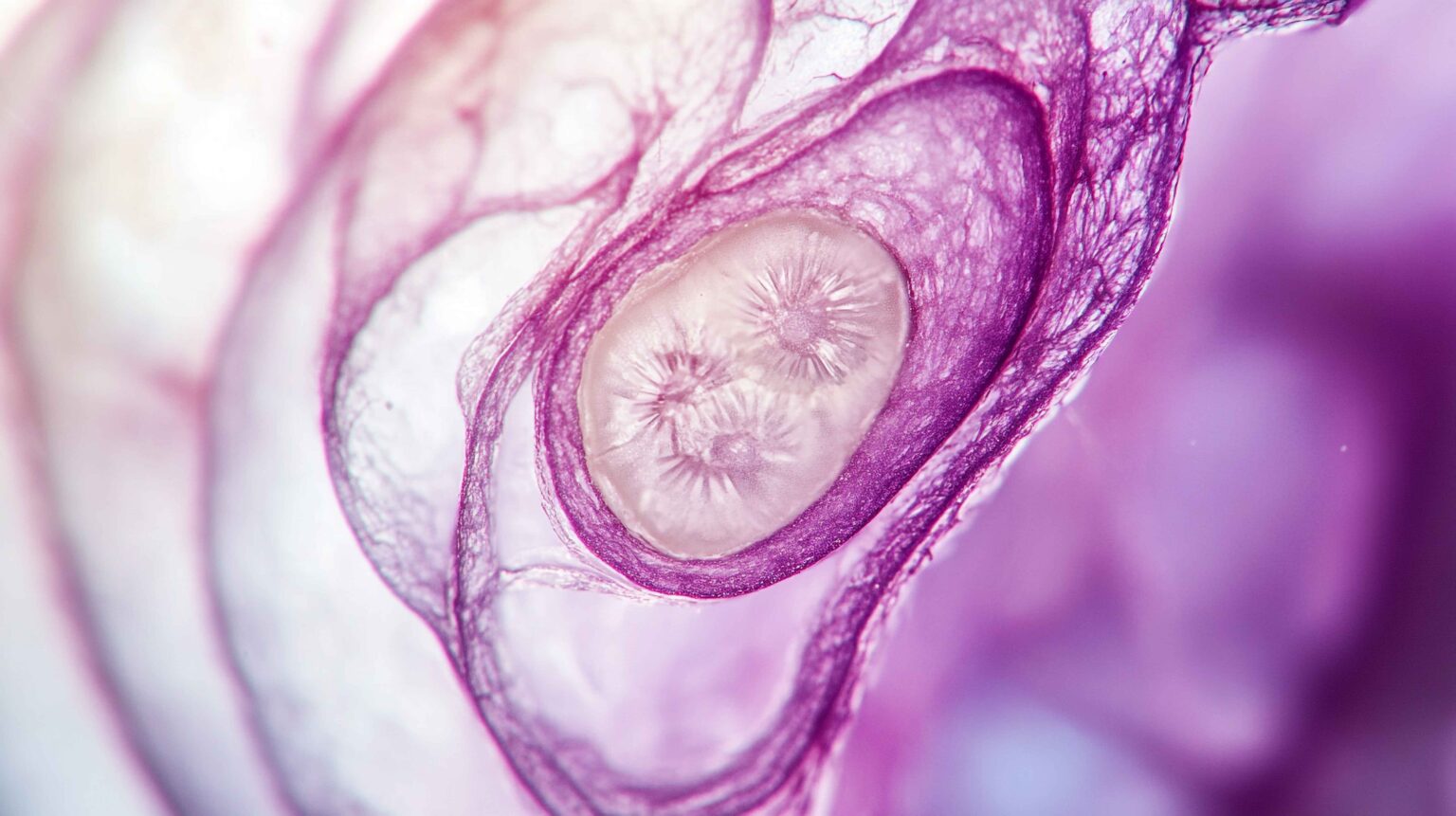 Muscle Atrophy Tissue Samples for Research Purposes