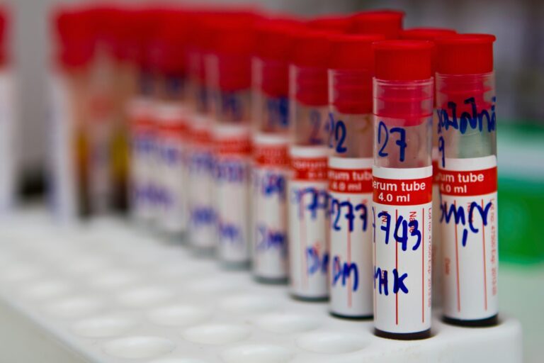 Creatine Kinase (CK) Test: Uses, Levels, and Clinical Significance