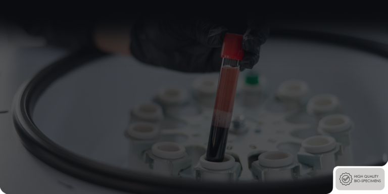 High Quality Human Biospecimen Sets & Formats for Research