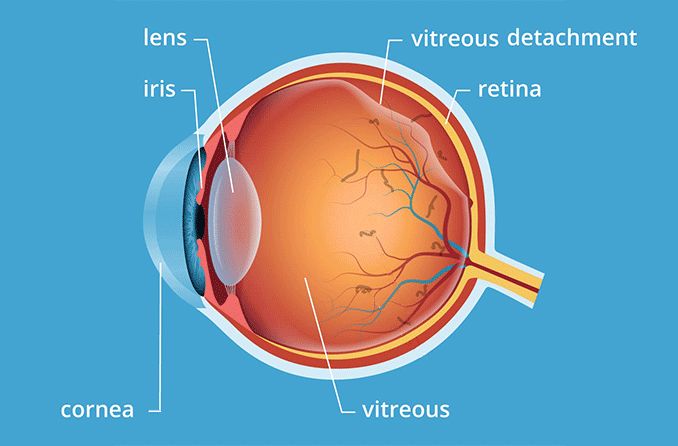 is glutathione in vitreous humor The composed of a network of collagen fibers and Vitreous Humor Samples for Research