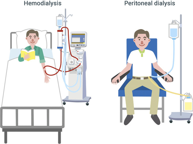 hemodylasis patient